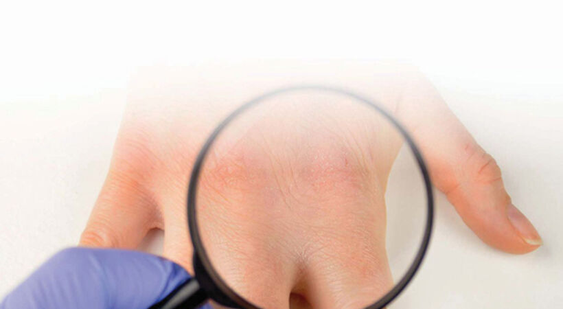 Advice on avoiding workplace skin damage